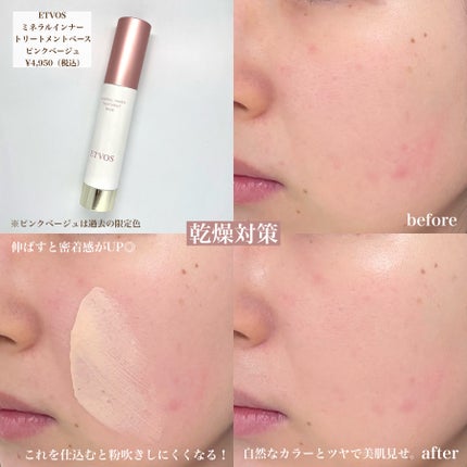 ディオールスキン フォーエヴァー スキン コレクト コンシーラー/Dior/リキッドコンシーラーを使ったクチコミ(3枚目)