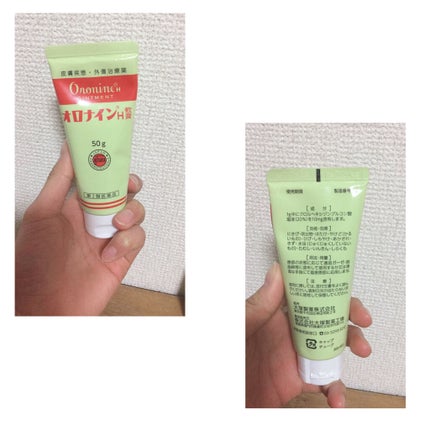 オロナインH軟膏 (医薬品)/オロナイン/その他を使ったクチコミ(3枚目)