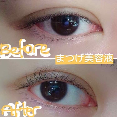 フローフシ THE まつげ美容液 FLOWFUSHI Lash Serum

＊実はこんな大げさではなく、写真の角度の問題かもしれません！

以前、マジョリカ、DHC、AVANCÉ、海外ブランドなとのま