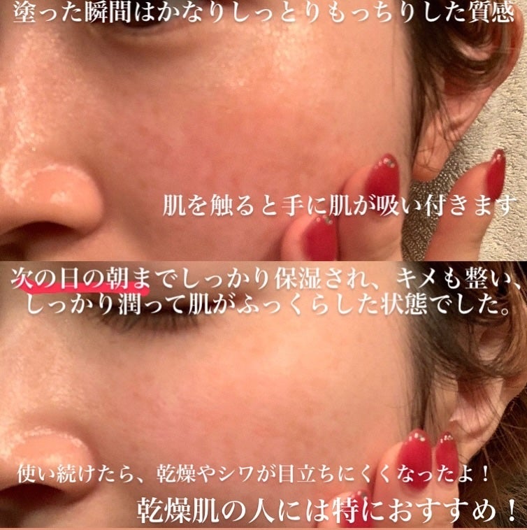 BTXクリームアンプル/MAXCLINIC/フェイスクリームを使ったクチコミ(4枚目)