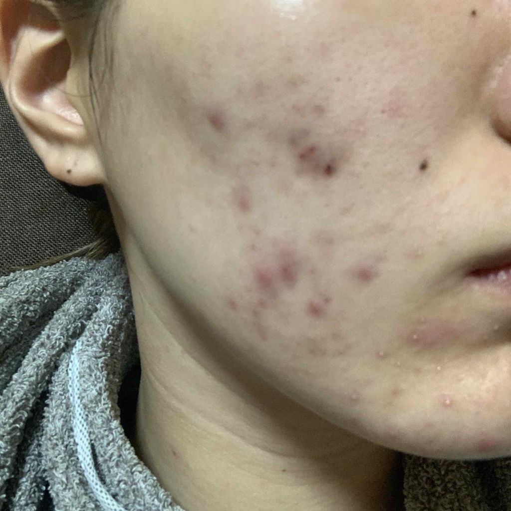 ハトムギ保湿ジェル(ナチュリエ スキンコンディショニングジェル)/ナチュリエ/美容液を使ったクチコミ（2枚目）