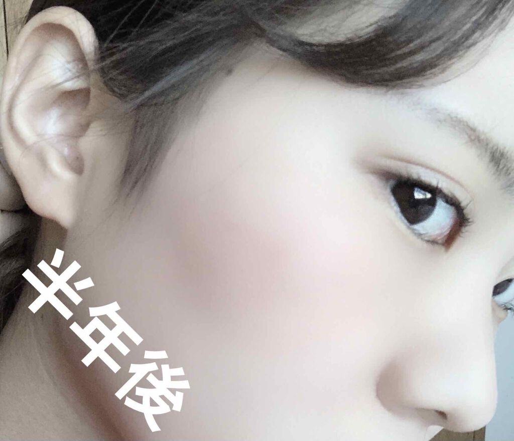 onigirið on LIPS ããã«ããã§ãïŒä»åã¯ç§ã®ãã£ãšæ¹åããªãã£ãã«ãã³ãããã¡ã®ã..ãïŒ4æç®ïŒ