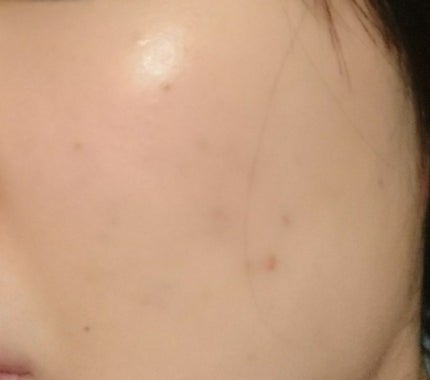 プロポリス エネルギーアンプル/CNP Laboratory/美容液を使ったクチコミ(3枚目)