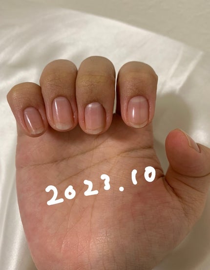 エテュセ クイックケアコート/ettusais/ネイルオイル・トリートメントを使ったクチコミ(10枚目)