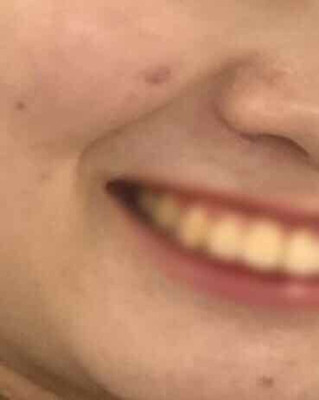 ソニック システム ピュリファイング クレンジング ブラシ/CLINIQUE/美顔器・マッサージを使ったクチコミ(3枚目)