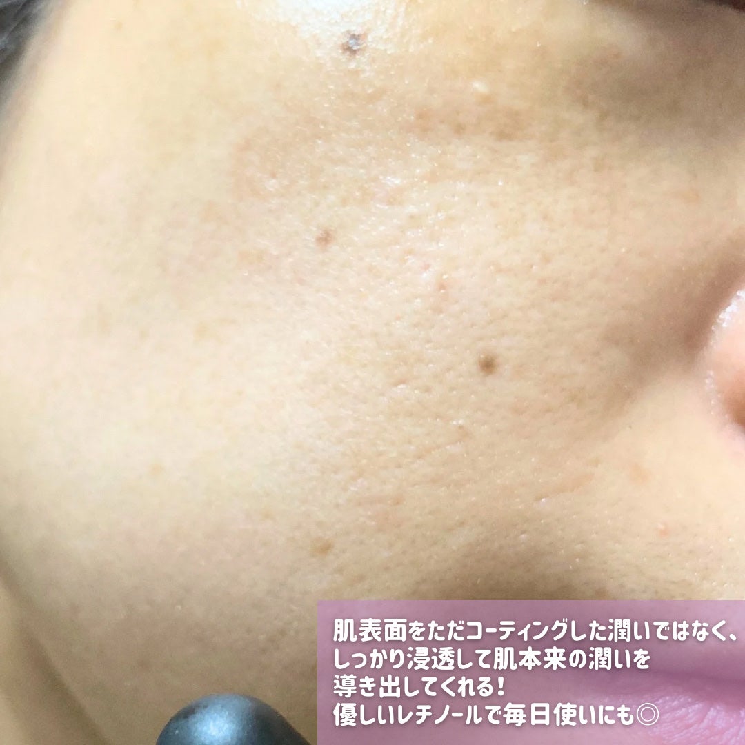 ブラックスネイルレチノールセラム/Dr.G/美容液を使ったクチコミ(5枚目)