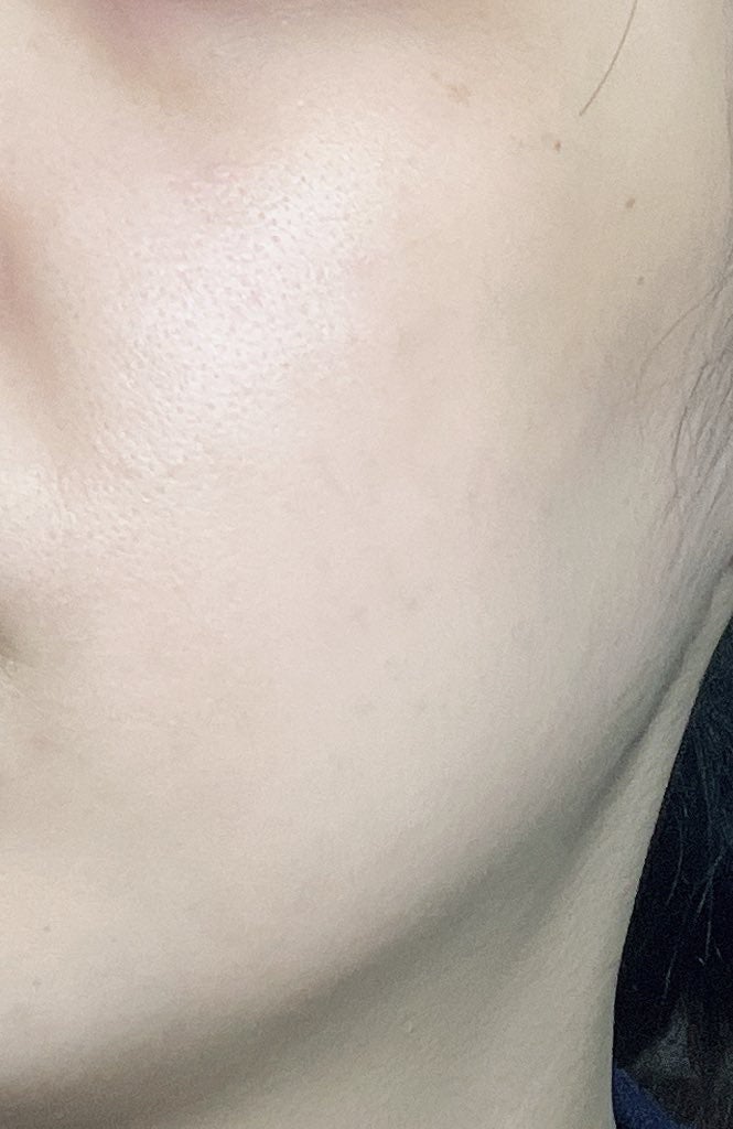 RMK Wトリートメントオイル/RMK/ブースター・導入液を使ったクチコミ(3枚目)