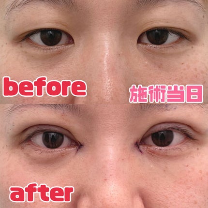 を使ったクチコミ(1枚目)