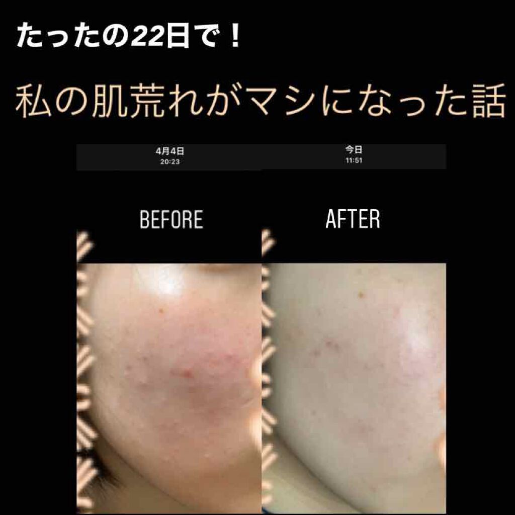 ハトムギ化粧水(ナチュリエ スキンコンディショナー R )/ナチュリエ/化粧水を使ったクチコミ(1枚目)