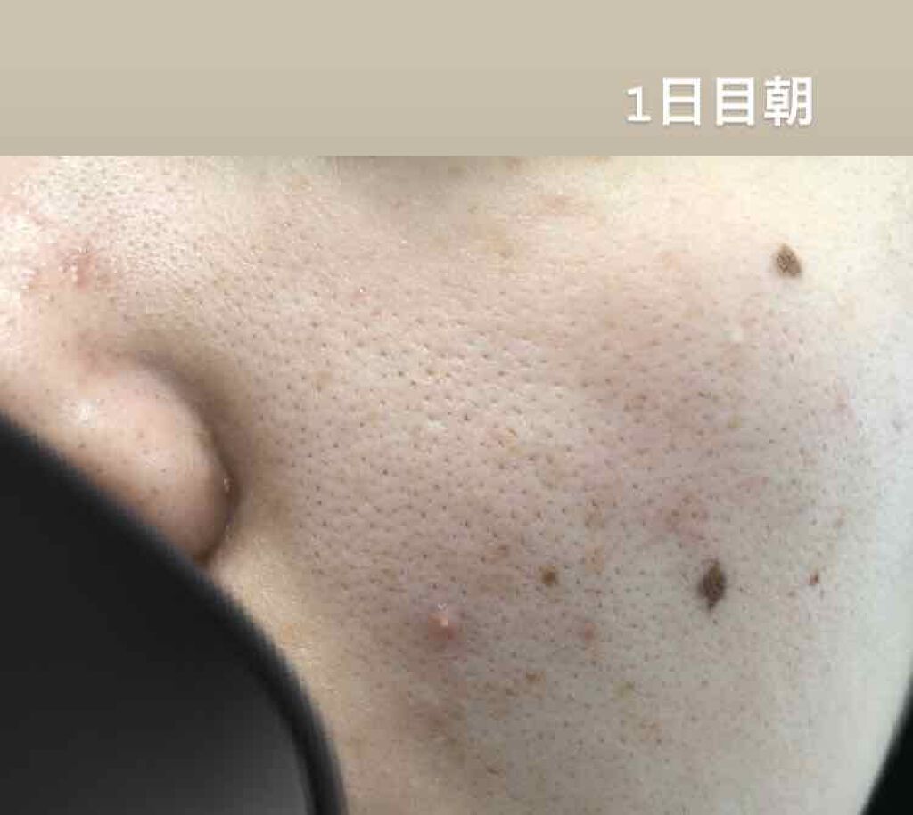 マスキング レイアリング アンプル /MEDIHEAL/美容液を使ったクチコミ(4枚目)