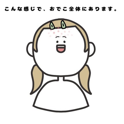 オロナインH軟膏 (医薬品)/オロナイン/その他を使ったクチコミ(2枚目)