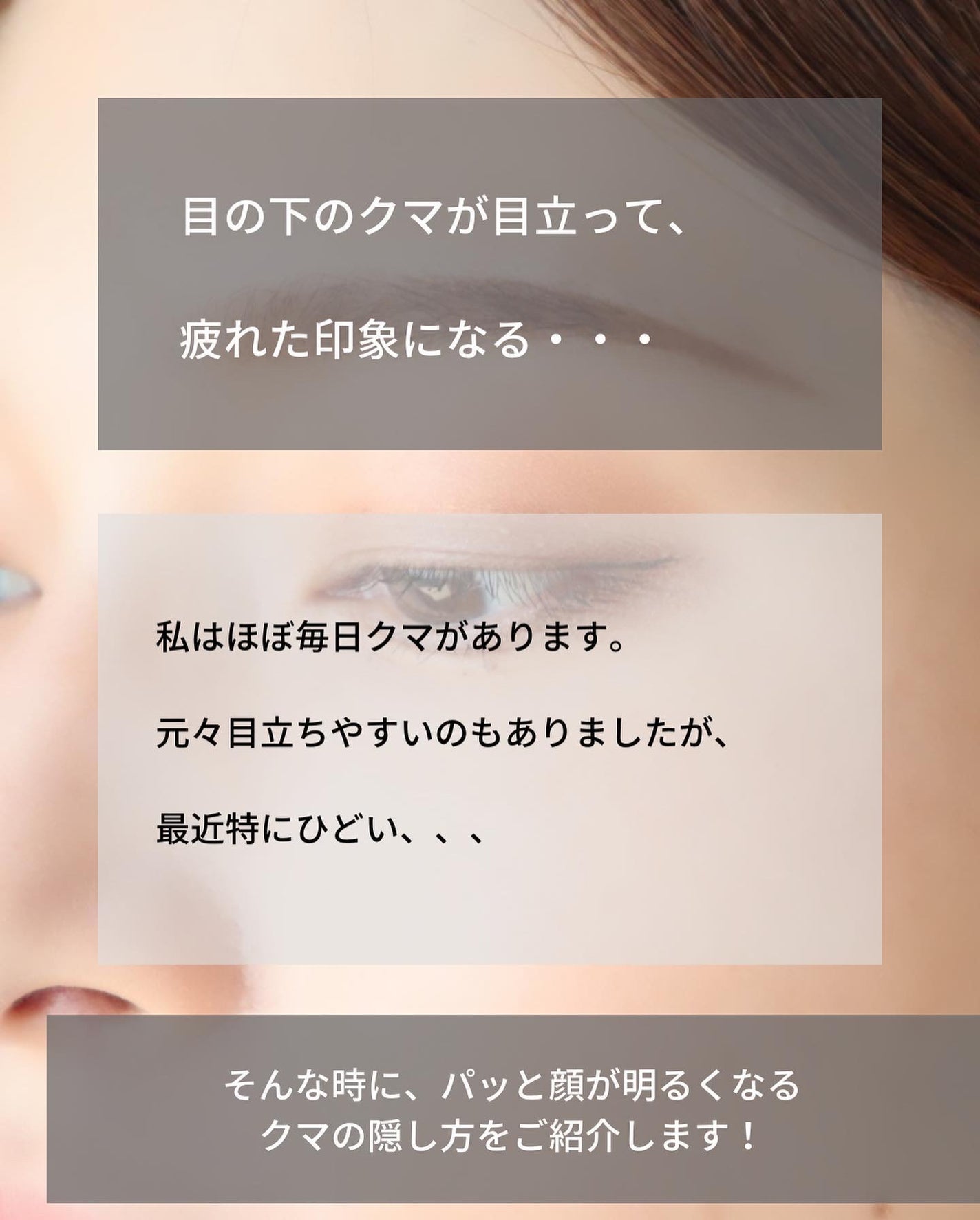 フローレス フュージョン ウルトラ ロングウェア コンシーラー/ローラ メルシエ/リキッドコンシーラーを使ったクチコミ(2枚目)