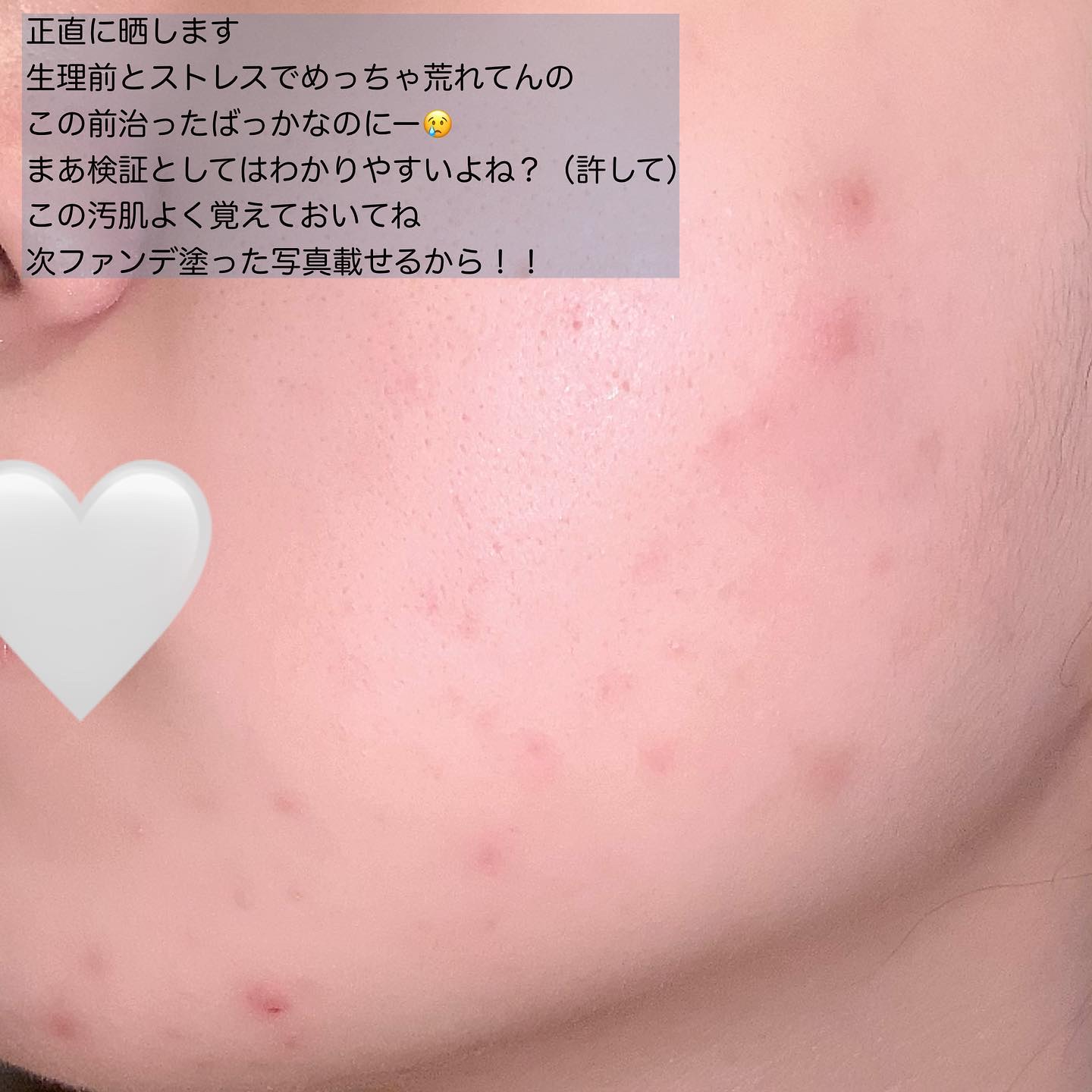 スキンフィットグラインディングセラムカバーパクト/ダルバ/その他ファンデーションを使ったクチコミ（2枚目）