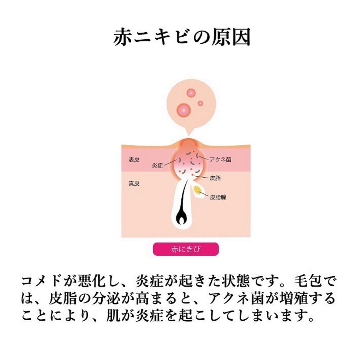 デュオ ザ クレンジングバーム クリア/DUO/クレンジングバームを使ったクチコミ(8枚目)