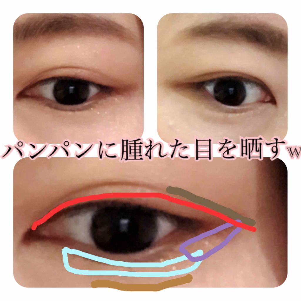 二重になる方法 Refa Carat Refaの使い方や二重メイク 泣き腫らした目をア By くま 敏感肌 代後半 Lips 二重になる方法 Refa Carat Refaの使い方や二重メイク 泣き腫らした目をア By くま 敏感肌 代後半 Lips