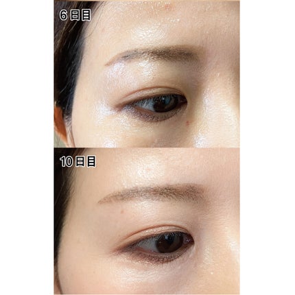 ピュアベール(医薬品)/プロペト/その他を使ったクチコミ(6枚目)