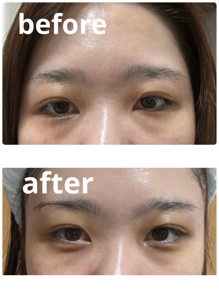 ザ セラム リンクルリペア 夜用 /アスタリフト/美容液を使ったクチコミ(2枚目)