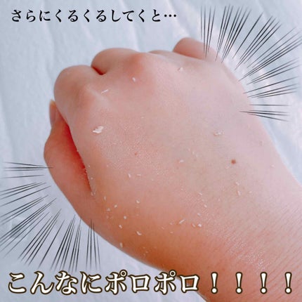 ナチュラルクッションピーリング/アカラン/ピーリングを使ったクチコミ(4枚目)