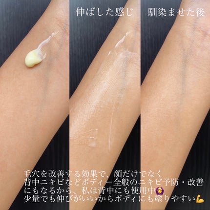 RXザ・ビタミンC23セラム/COSRX/美容液を使ったクチコミ(7枚目)