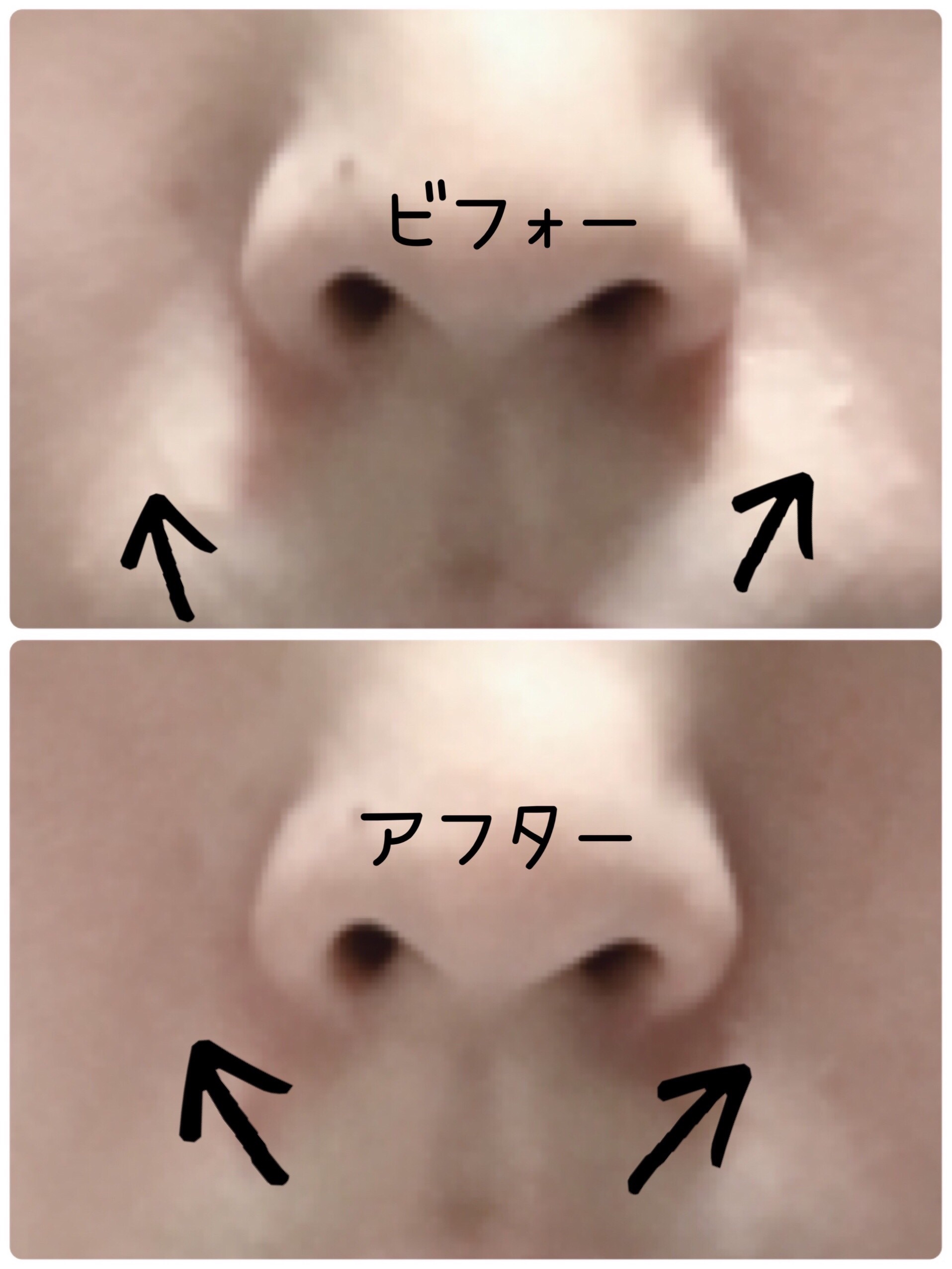 ReFa CARAT/ReFa/ボディケア美容家電を使ったクチコミ（2枚目）