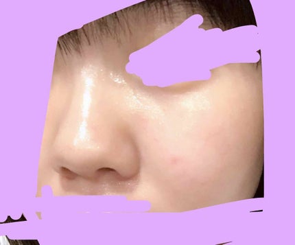 ワンステップオリジナルクリアパッド/COSRX/トナーパッドを使ったクチコミ(4枚目)