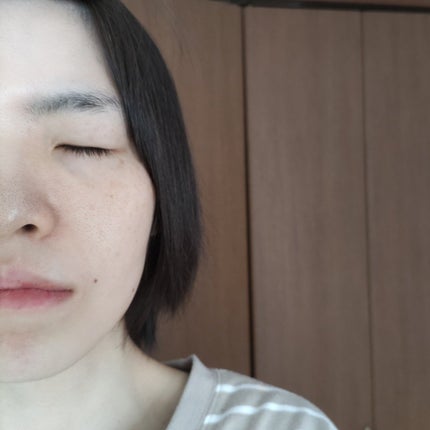 オードムーゲ 薬用ローション(ふきとり化粧水)/オードムーゲ/拭き取り化粧水を使ったクチコミ(6枚目)