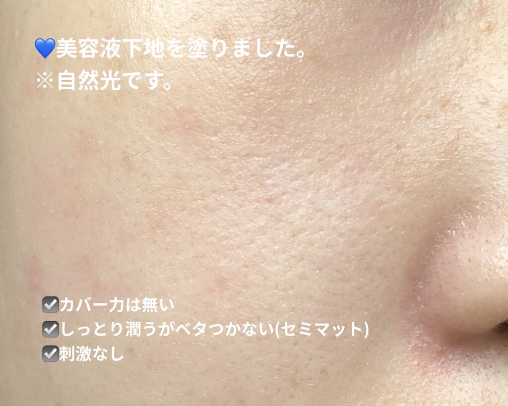 薬用 スキンケア パウダー/アクネオ/プレストパウダーを使ったクチコミ（2枚目）