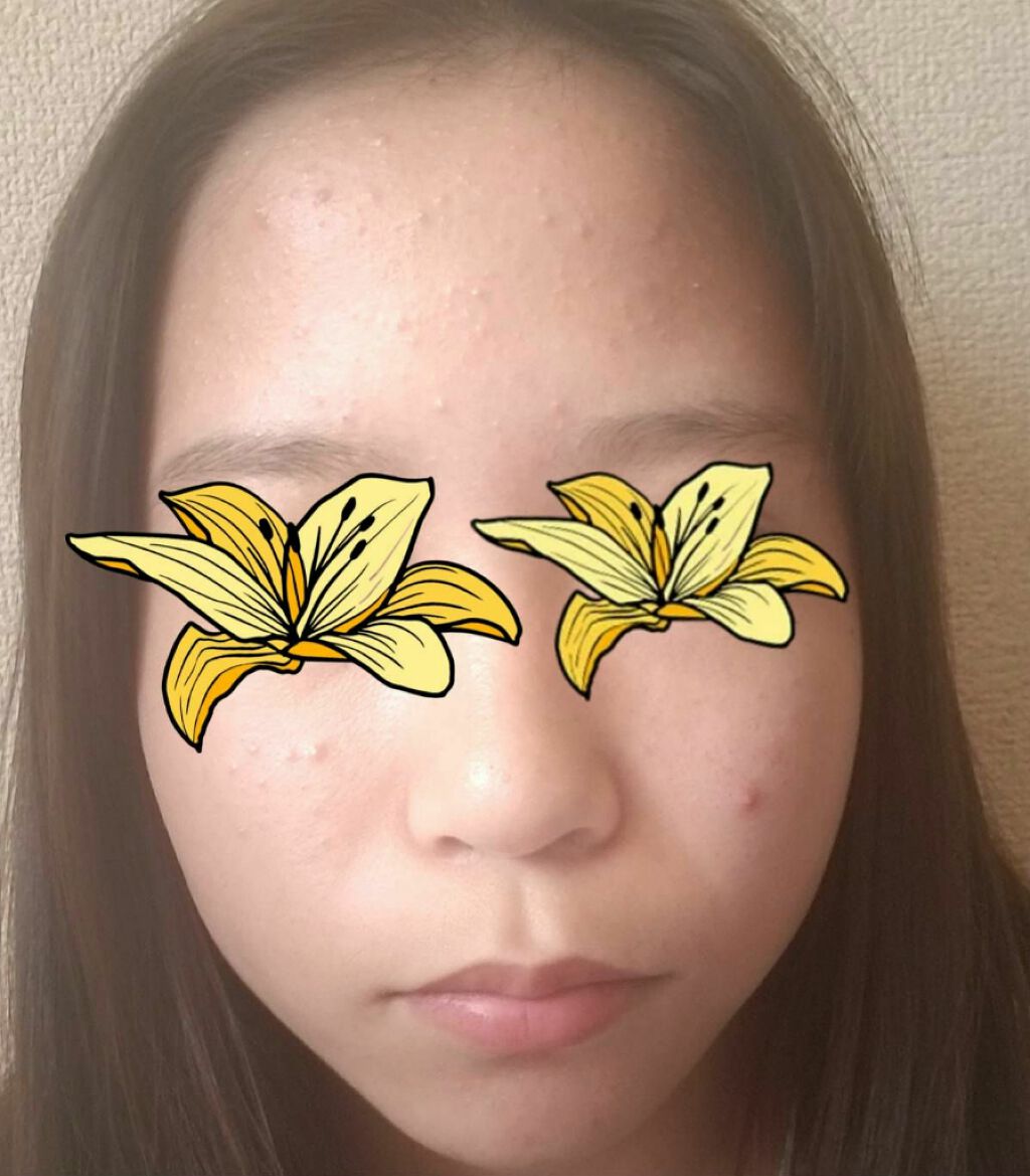 A アクネフォーム/NOV/洗顔フォームを使ったクチコミ(2枚目)