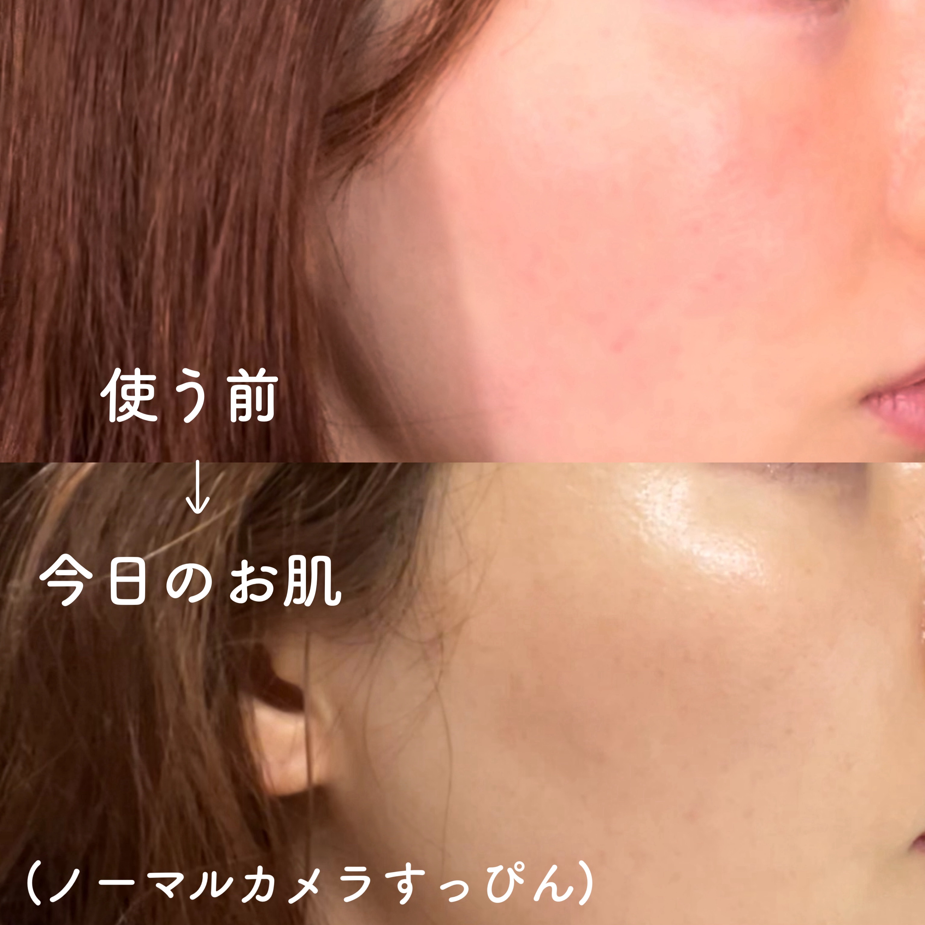 ビタペアC ビタレチ美容液/ネイチャーリパブリック/美容液を使ったクチコミ（2枚目）