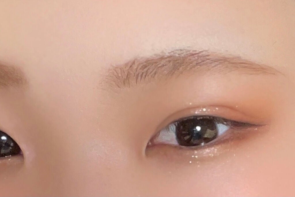 もも on LIPS 「【初投稿】埋没法記録自分用のメモとして投稿します1枚目上施術前..」(3枚目)