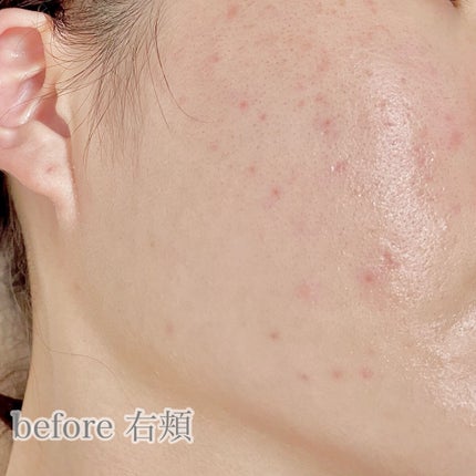 ピュア ナチュラル エッセンスローション リフト /pdc/オールインワン化粧品を使ったクチコミ(4枚目)