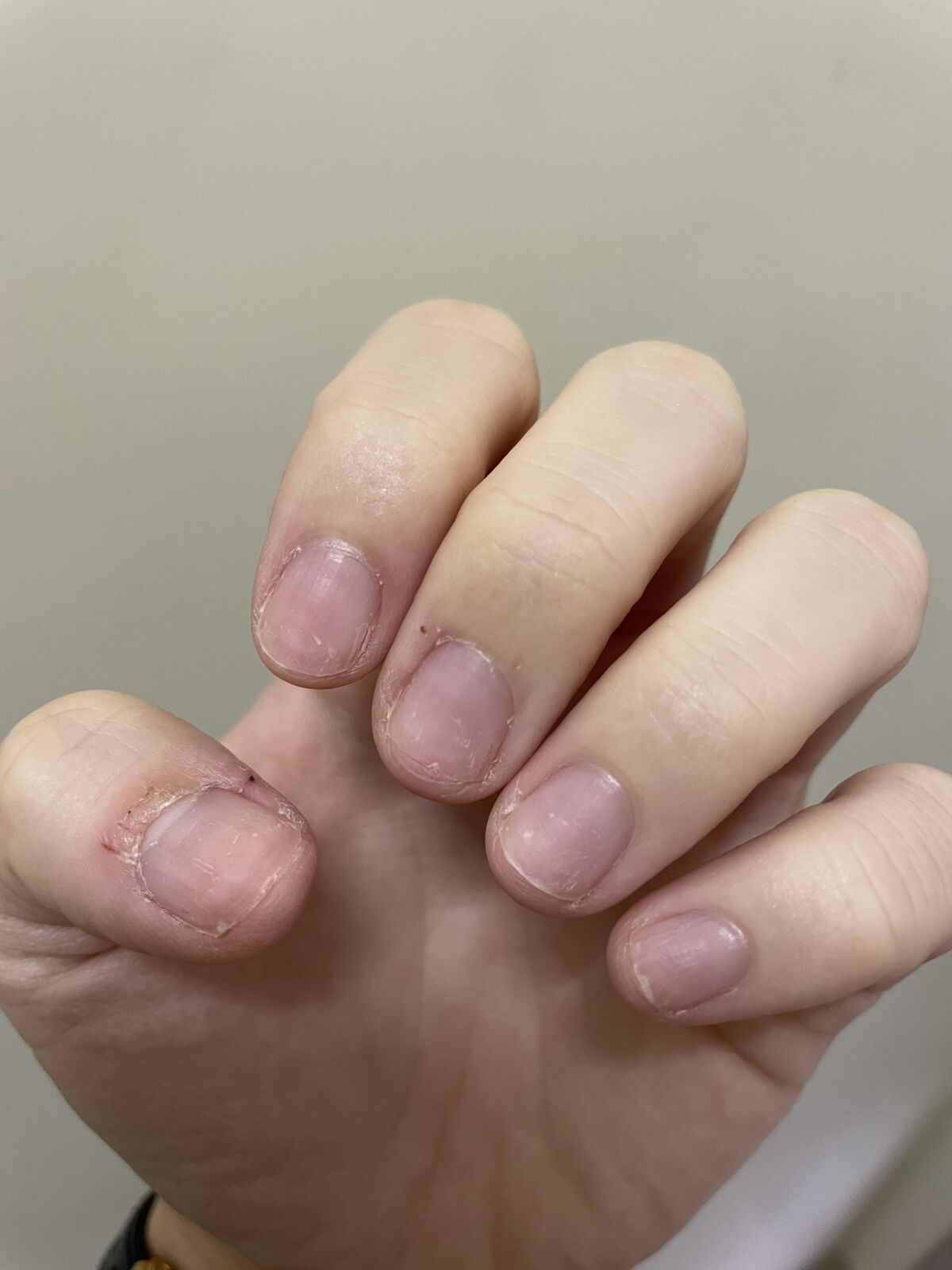 ディーアップファンデーション ナチュラルピンク/D-UP/ネイルベースコートを使ったクチコミ（2枚目）