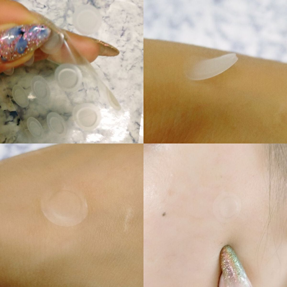 ゼロスポットパッチ/Today’s Cosme/にきびパッチを使ったクチコミ(2枚目)