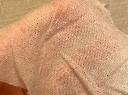 ディープケアマスク パール/RISM/シートマスク・パックを使ったクチコミ(2枚目)