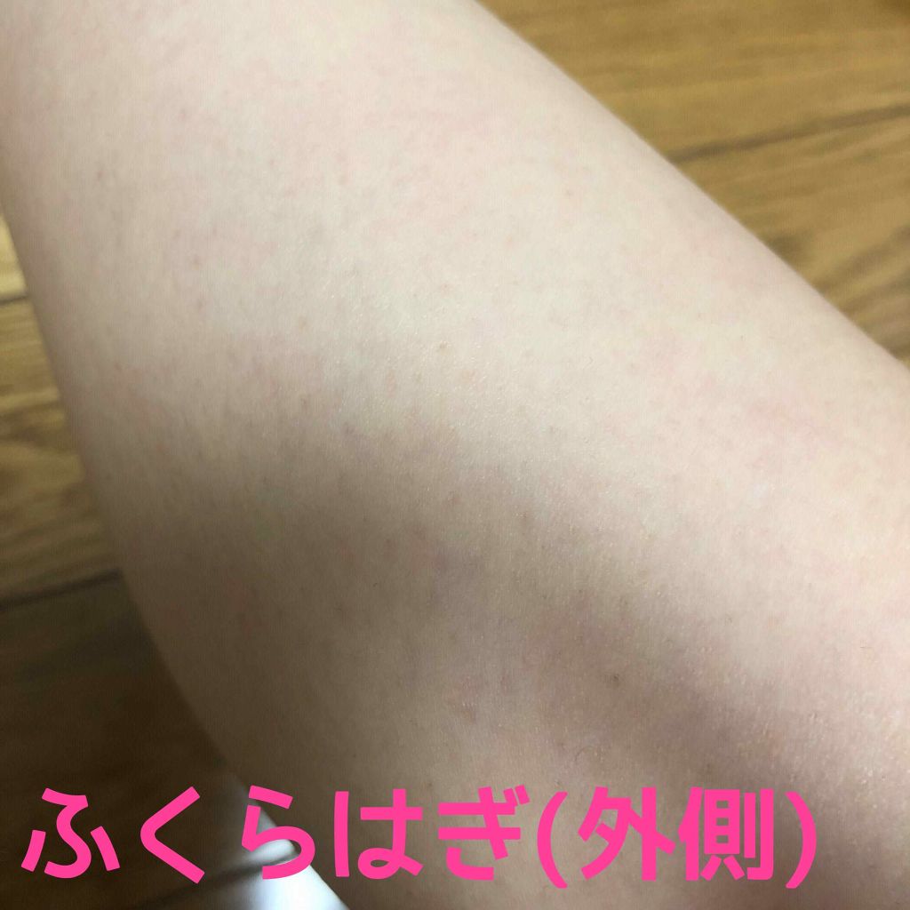 光美容器KE-NON(ケノン)/エムテック/家庭用脱毛器を使ったクチコミ(3枚目)