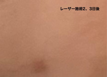 シードナイトクリーム/SEED-D/フェイスクリームを使ったクチコミ(5枚目)