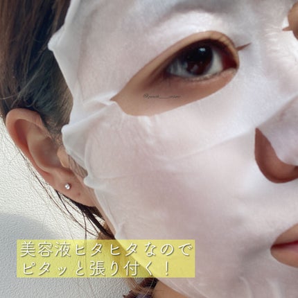 スポットイレーザー ビタマスク/BY ECOM/シートマスク・パックを使ったクチコミ(3枚目)