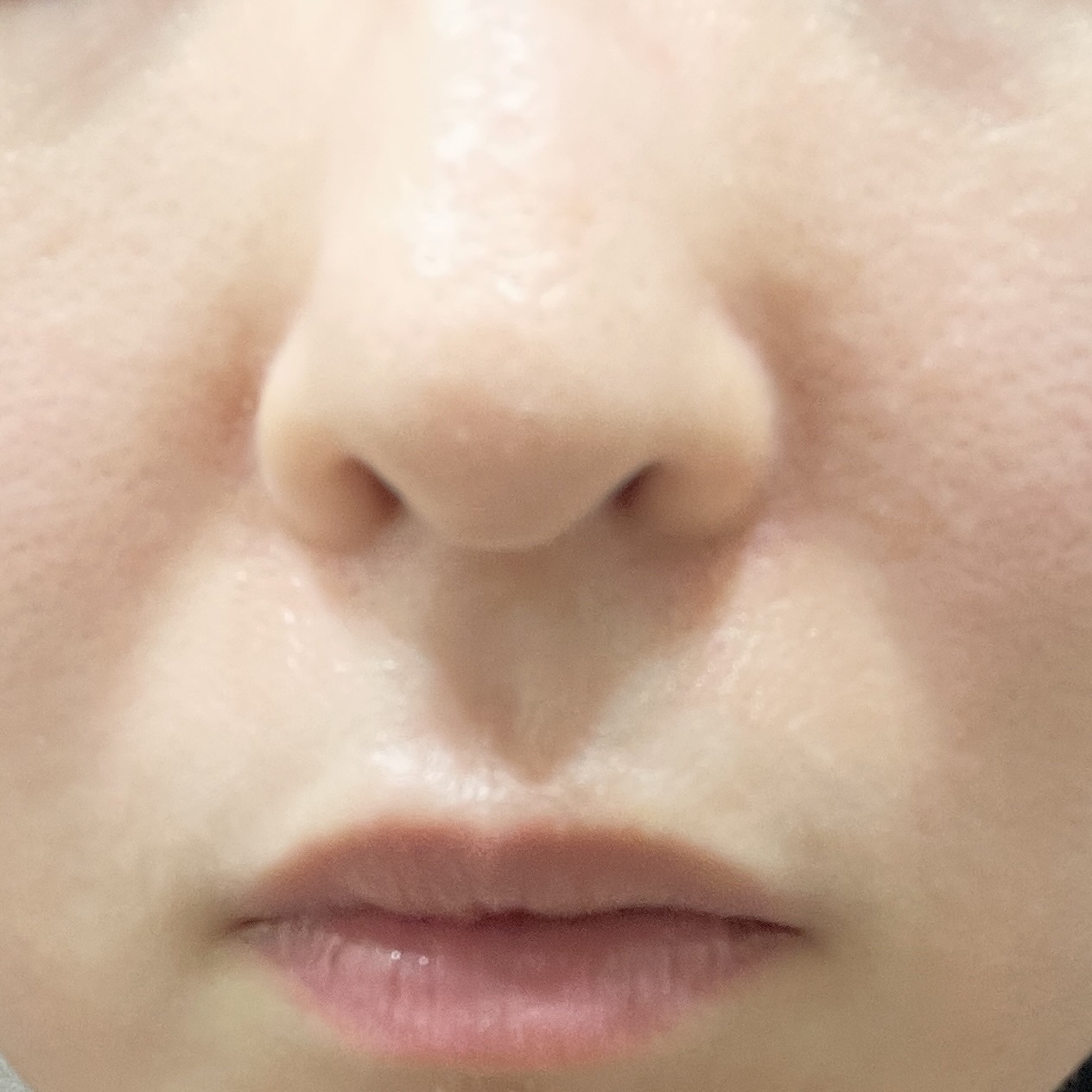 ドクダミ ポアコントロールクレンジングオイル/Anua/オイルクレンジングを使ったクチコミ（3枚目）