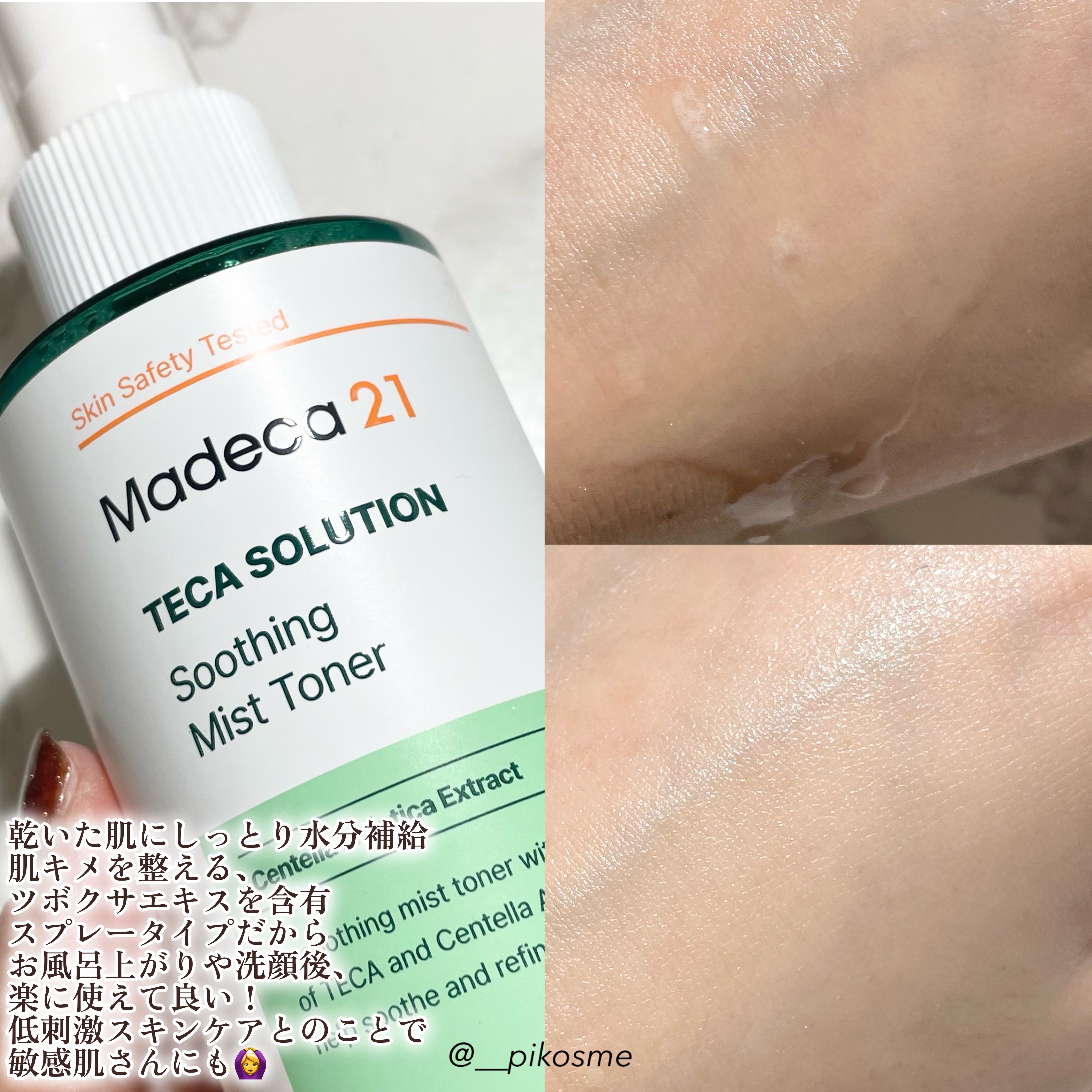 テカソルーションスージングミストトナー/Madeca21/ミスト状化粧水を使ったクチコミ（2枚目）