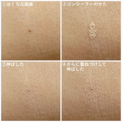 タトゥーウォータープルーフスカーコンシーラー/フォレンコス/リキッドコンシーラーを使ったクチコミ(5枚目)