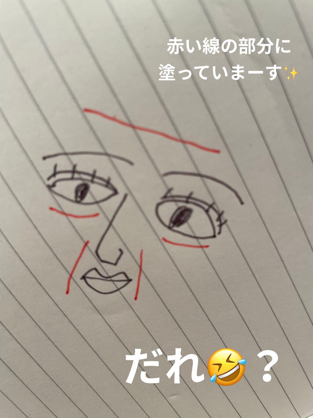 リンクルショット メディカル セラム N/リンクルショット/アイケア・アイクリームを使ったクチコミ(2枚目)