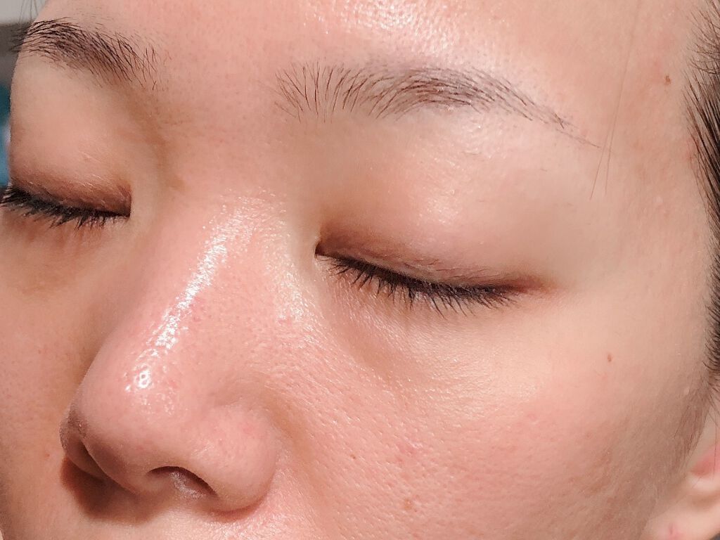 BEBETOXアンプルセット/YOU&ME/スキンケアキットを使ったクチコミ（2枚目）