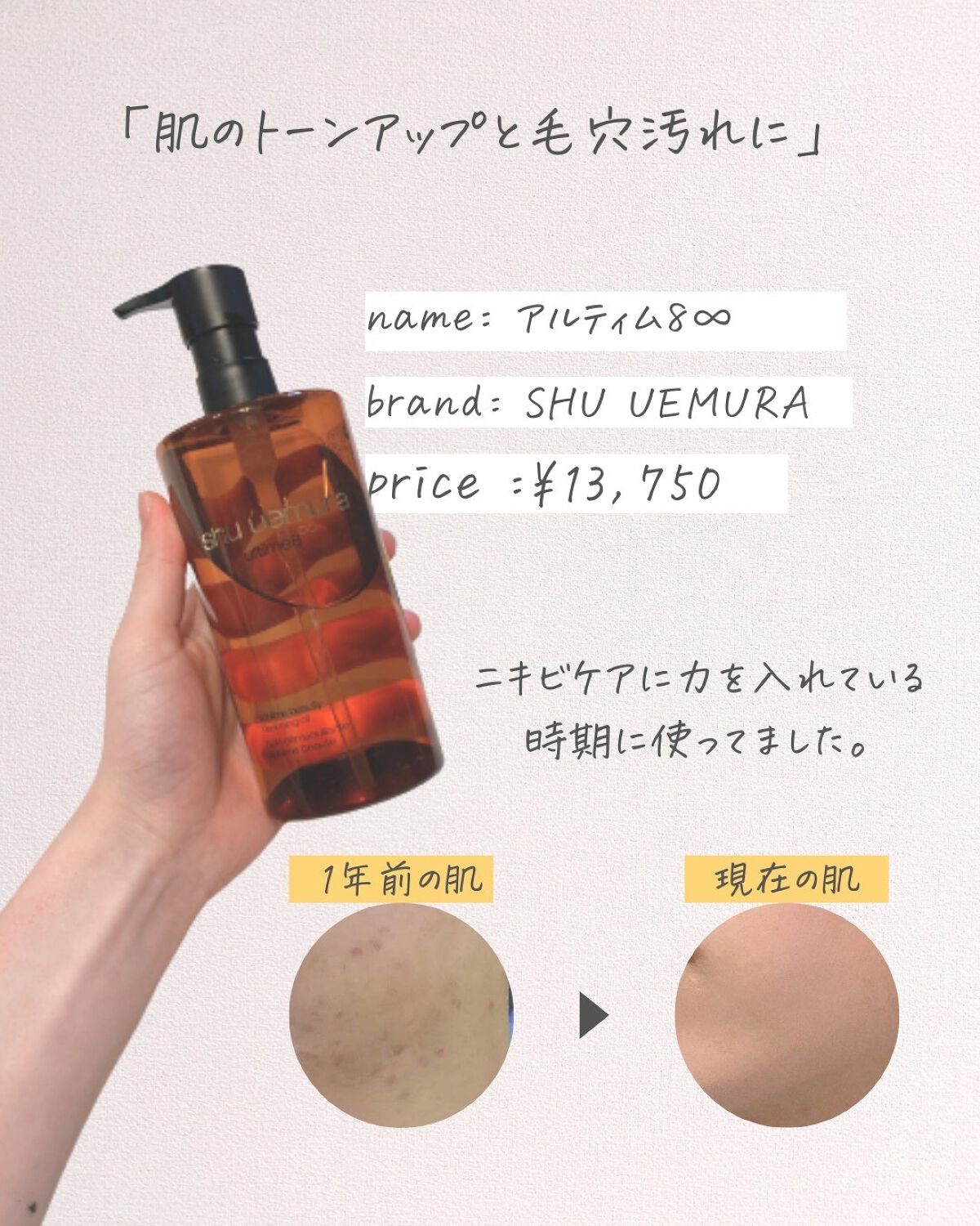 りん on LIPS 「@rin_._gra☚他の投稿はこちら本日も垢抜けに関するコツ..」(2枚目)