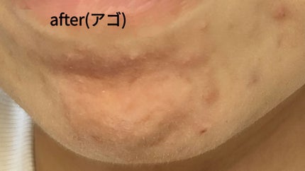 無添加米ぬか洗顔フォーム/ロゼット/洗顔フォームを使ったクチコミ(3枚目)