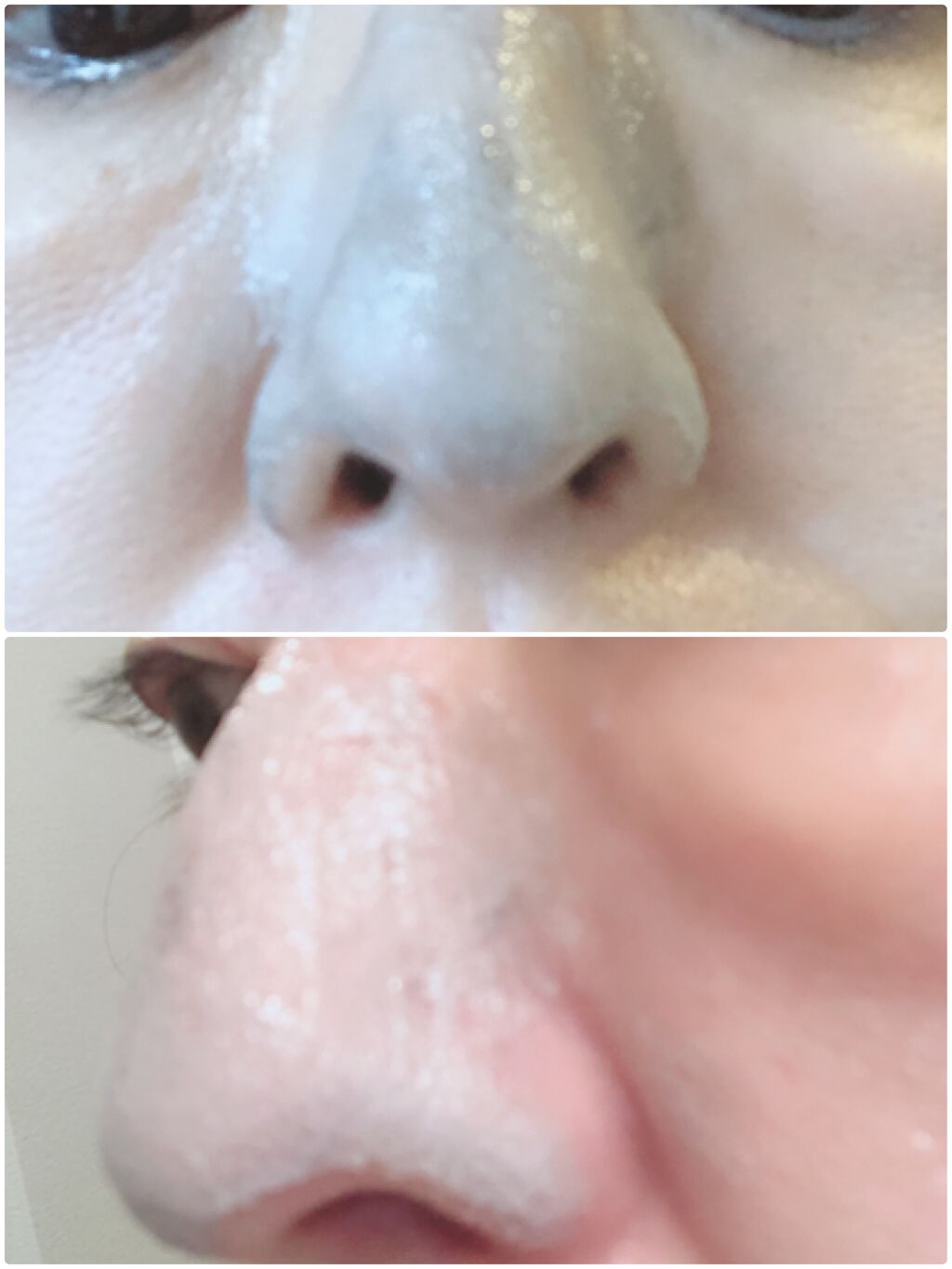 JUSO KURO PACK/NAKUNA-RE/洗い流すパック・マスクを使ったクチコミ(3枚目)