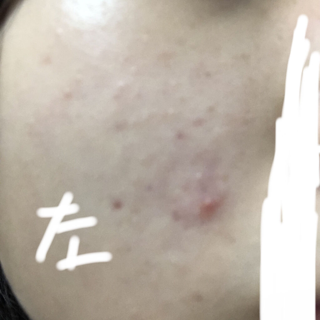 スキンケアセット（とてもしっとり）/IHADA/トライアルキットを使ったクチコミ（2枚目）