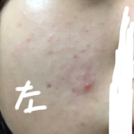 スキンケアセット(とてもしっとり)/IHADA/トライアルキットを使ったクチコミ(2枚目)