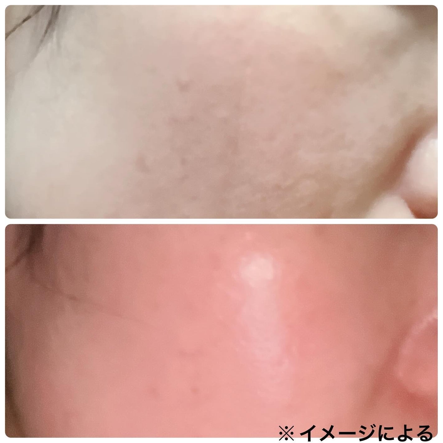 エンリッチ メディカリフト デュオセラム/ドクターシーラボⓇ/美容液を使ったクチコミ(4枚目)