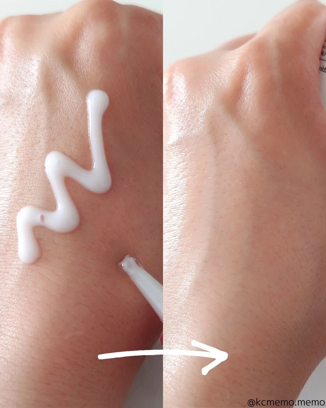 エーキュアスピキュールスポット/obsero/フェイスクリームを使ったクチコミ(3枚目)