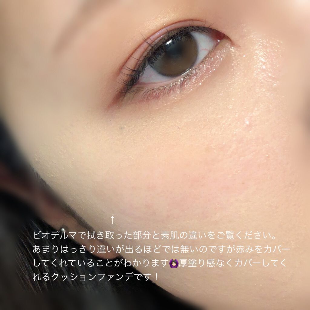 ピンクティーツリーカバークッション/APLIN/クッションファンデーションを使ったクチコミ(4枚目)